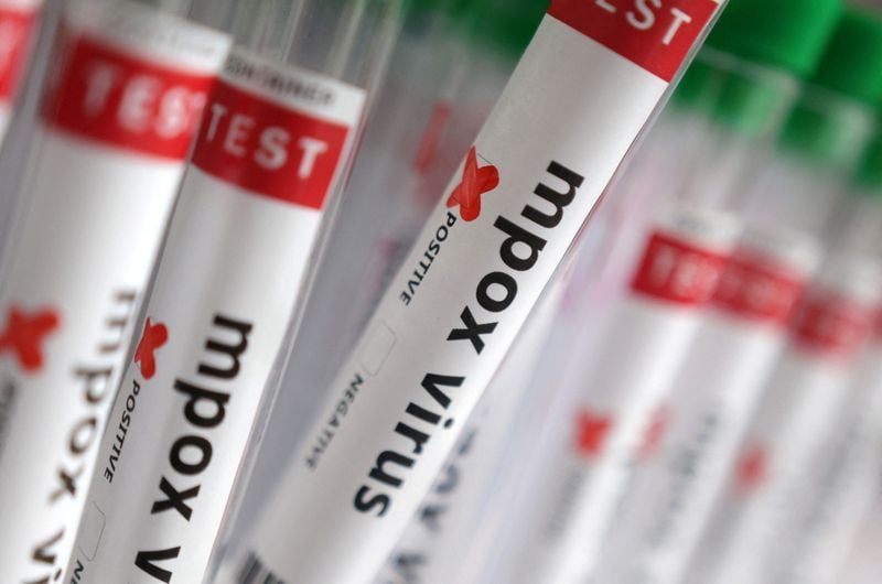 Featured image for article about Finance