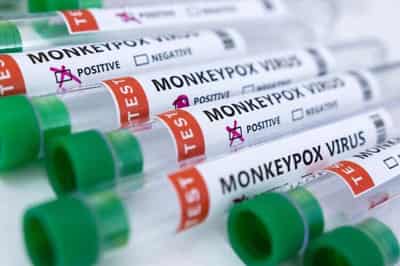 Image for Test makers target monkeypox market as cases surge