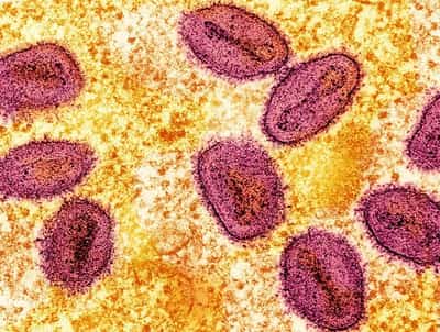 Image for Philippines detects first mpox case this year, yet to determine strain
