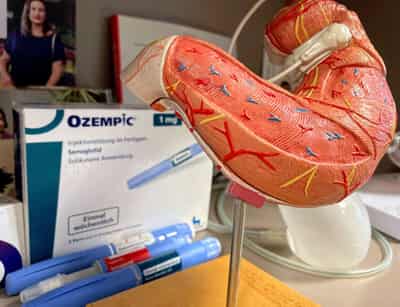Image for “Last hope”: Eager Germans are prepared to pay for weight-loss drug