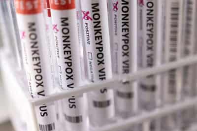 Image for Developing world should reap benefits of new monkeypox research, experts urge