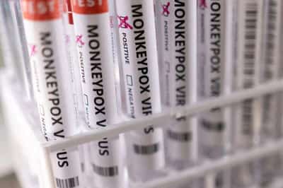Image for Developing world should reap benefits of new monkeypox research, experts urge