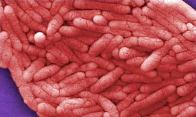 Image for Record salmonella outbreak in Belgium infects at least 306