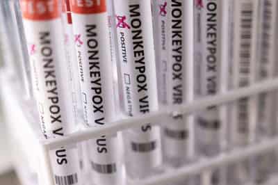 Image for WHO vows nothing ‘ridiculous’ as public submits ideas to rename monkeypox