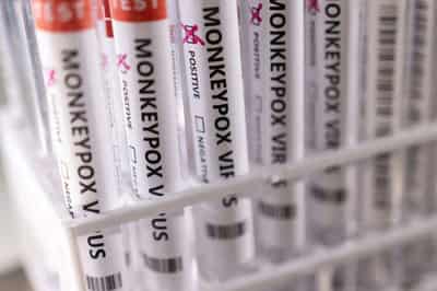 Image for WHO eyes decision on monkeypox ’emergency’, Africa says it’s long overdue