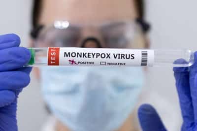 Image for Monkeypox emergency could last months, with window closing to stop spread, experts say