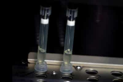 Image for WHO looks into reports of monkeypox virus in semen