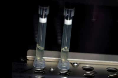 Image for WHO looks into reports of monkeypox virus in semen
