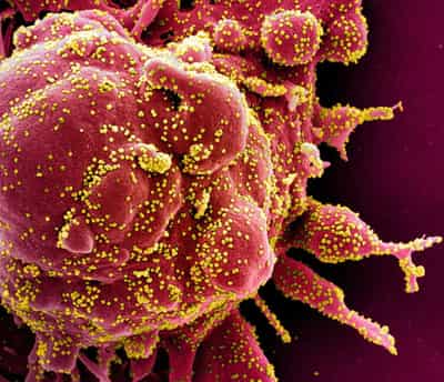 Image for Dual-antibody drugs effective against COVID-19 variants in animal study