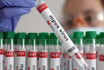 Image for Germany identifies its first case of new mpox variant