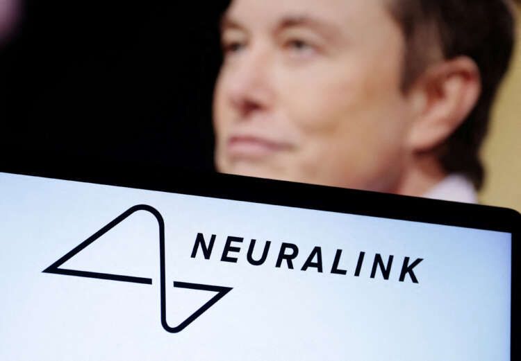 Image for Elon Musk’s Neuralink says has FDA approval for study of brain implants in humans